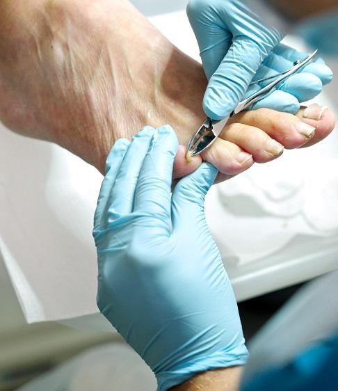 Behandeling van een voet