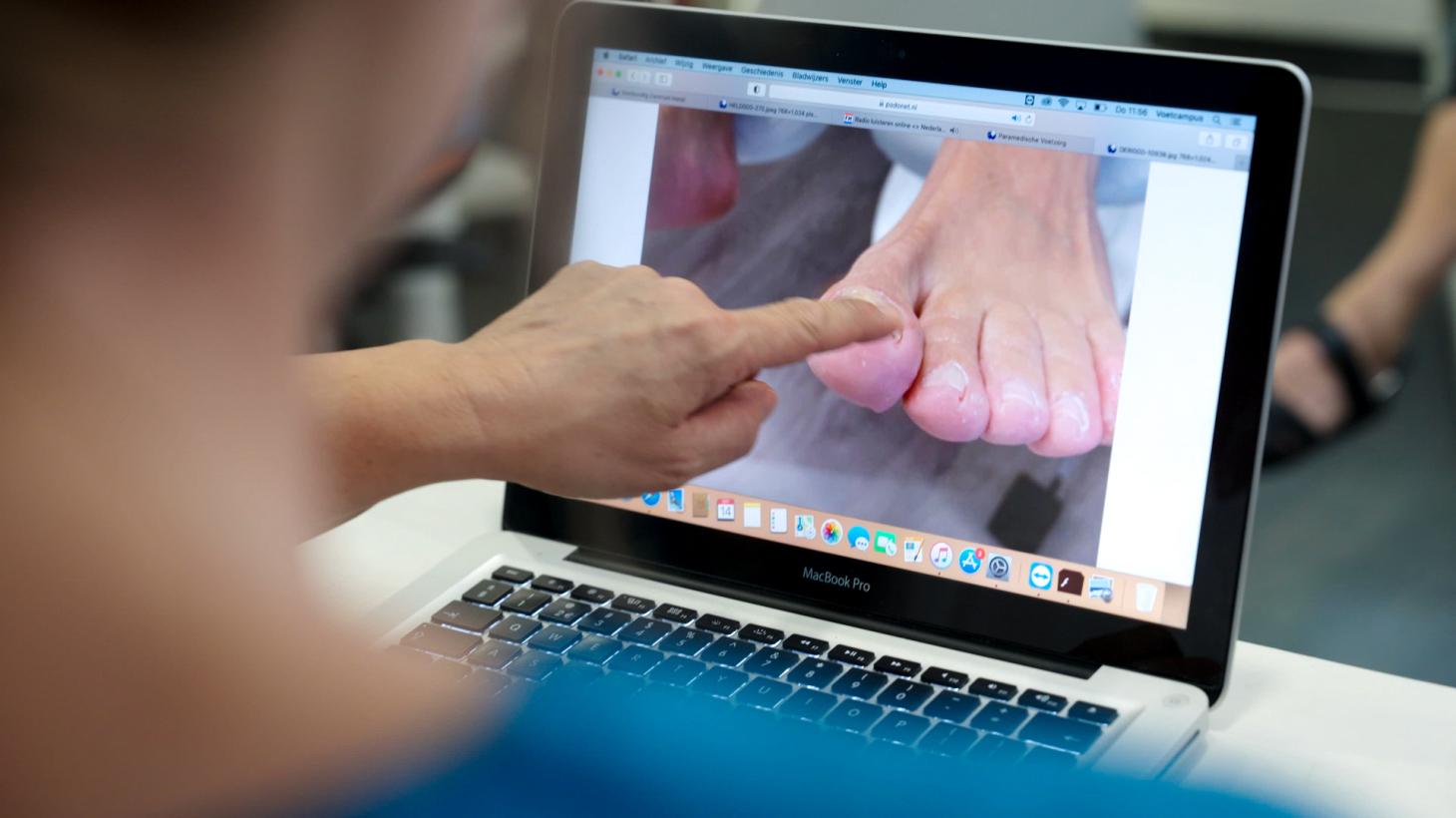 Beoordeling van een nagel op een laptop